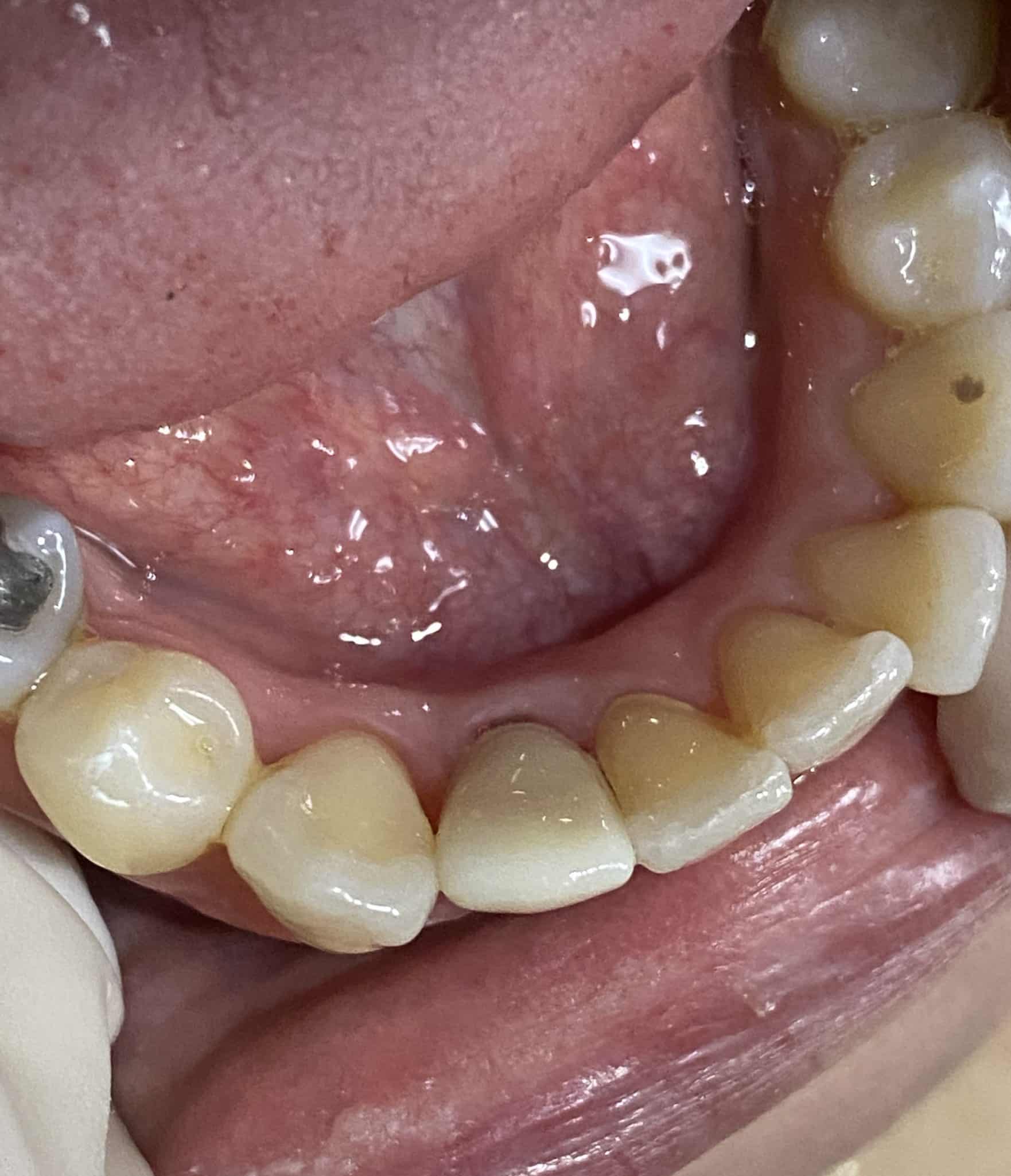 After Image