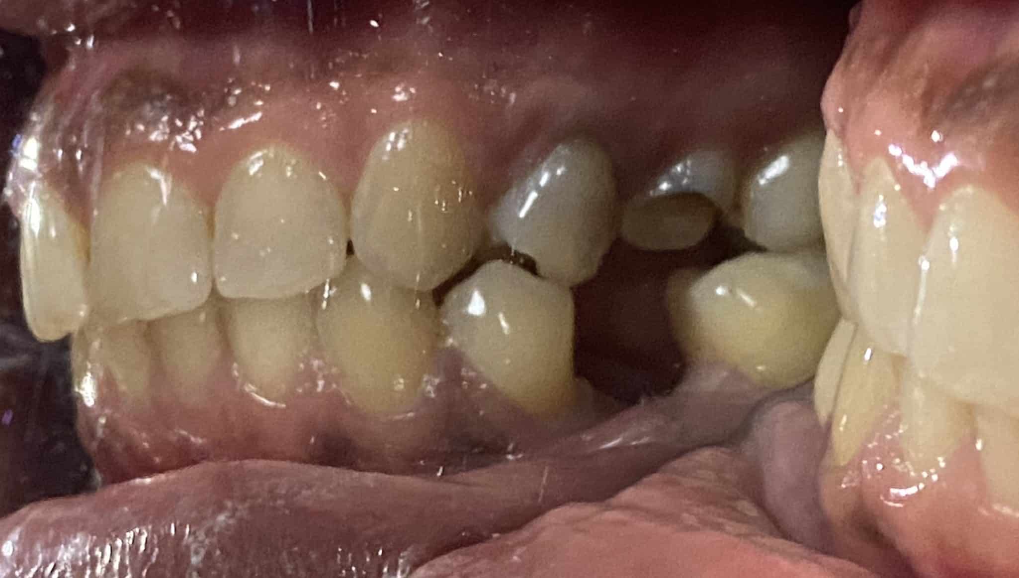 Before Image