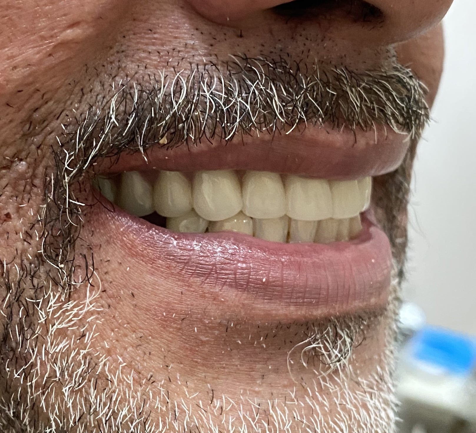 After Image