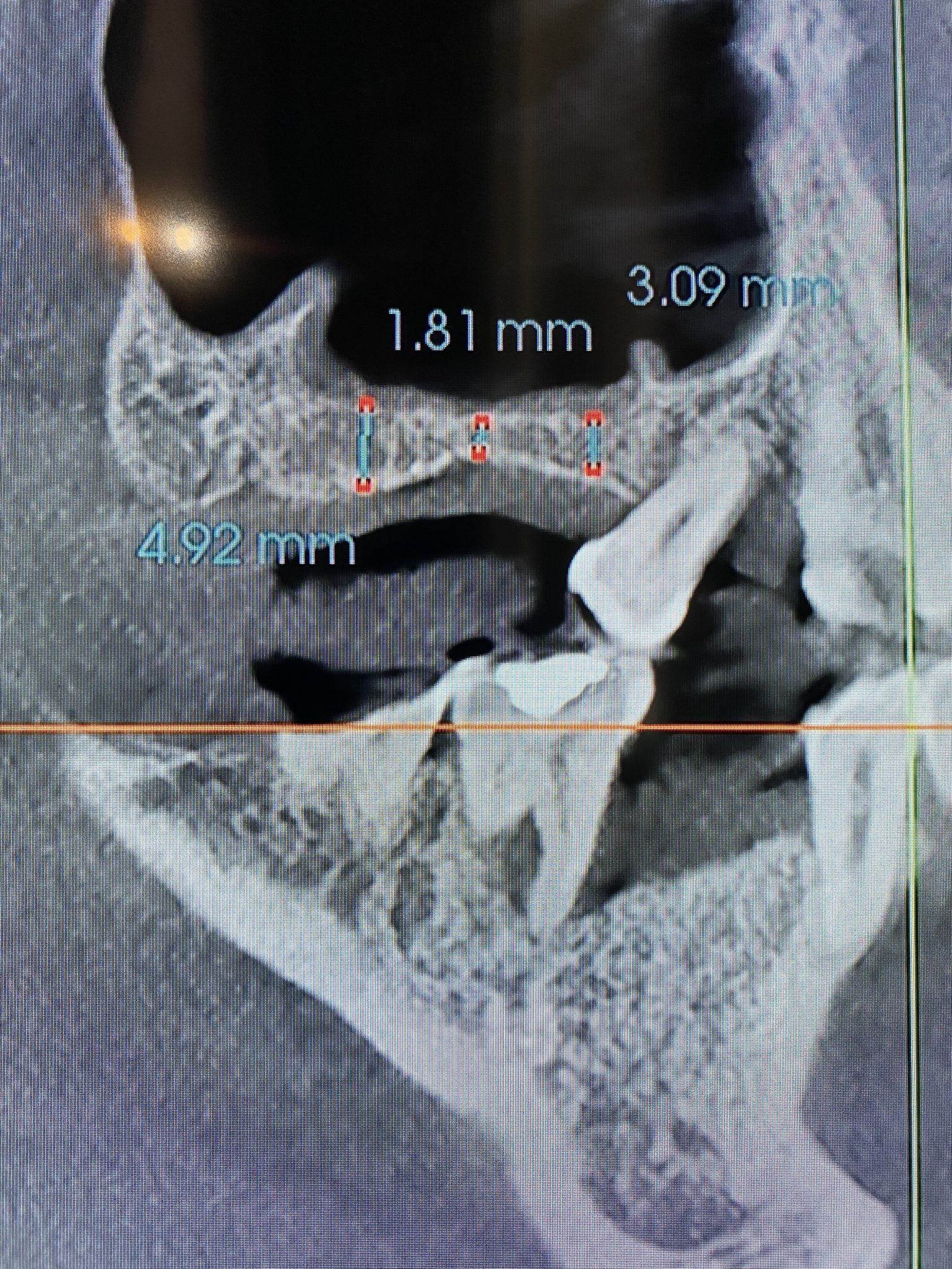 Before Image