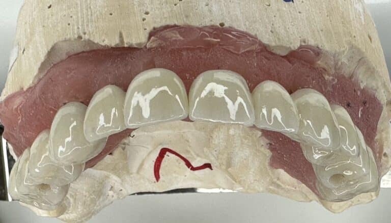 After Image